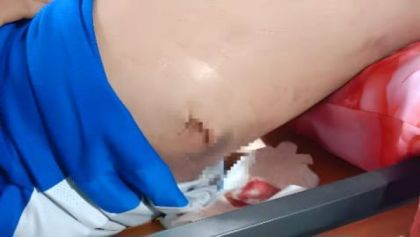 Oknum TNI Sewaan PT SEBAL Meresahkan, Sabet Pelajar hingga Alami Luka Menganga di Paha