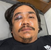 Berikut Pernyataan Korban Pengeroyokan di Kecamatan Mandau